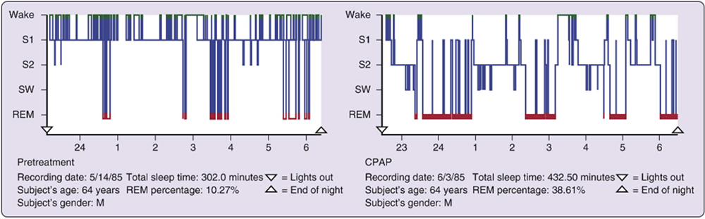 sleep histogram